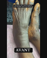 Crème Hydratante DR.DAVEY — 01 acheté_01 offert